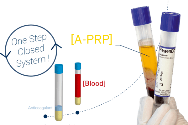 PRP terapija