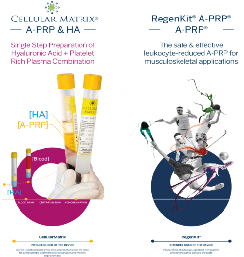 PRP terapija Regen Lab u sportskoj medicini